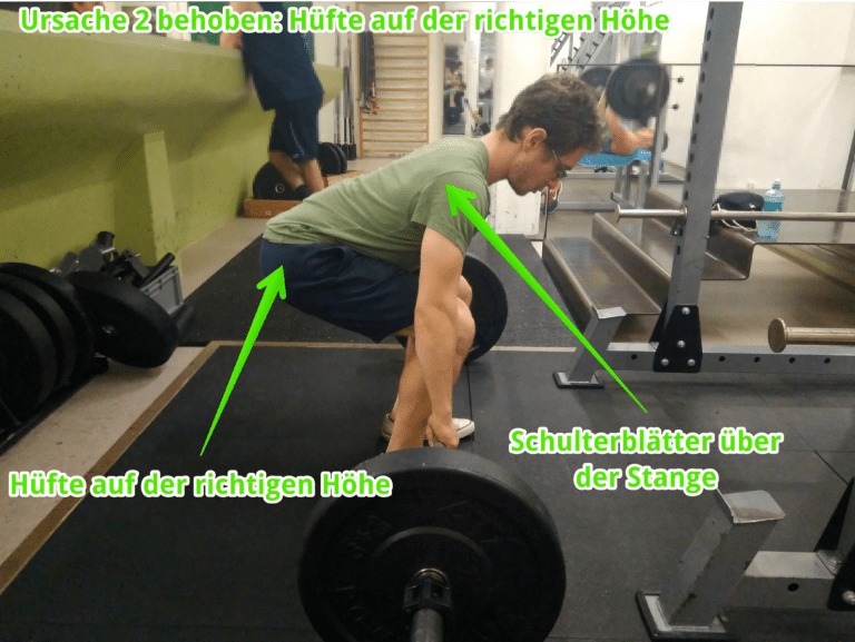 Rundet dein Rücken ein beim Kreuzheben? (Rundrücken vermeiden) Dr. Dotzauer