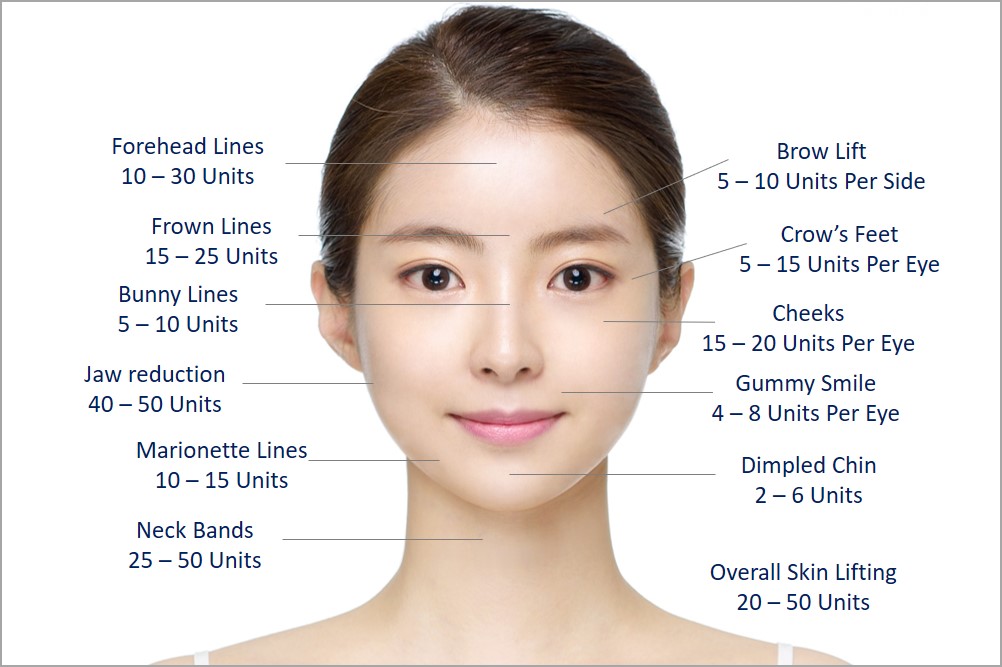 How Many Units Of Botox Do You Need? Jaw Reduction, Crow’s Feet, Frown