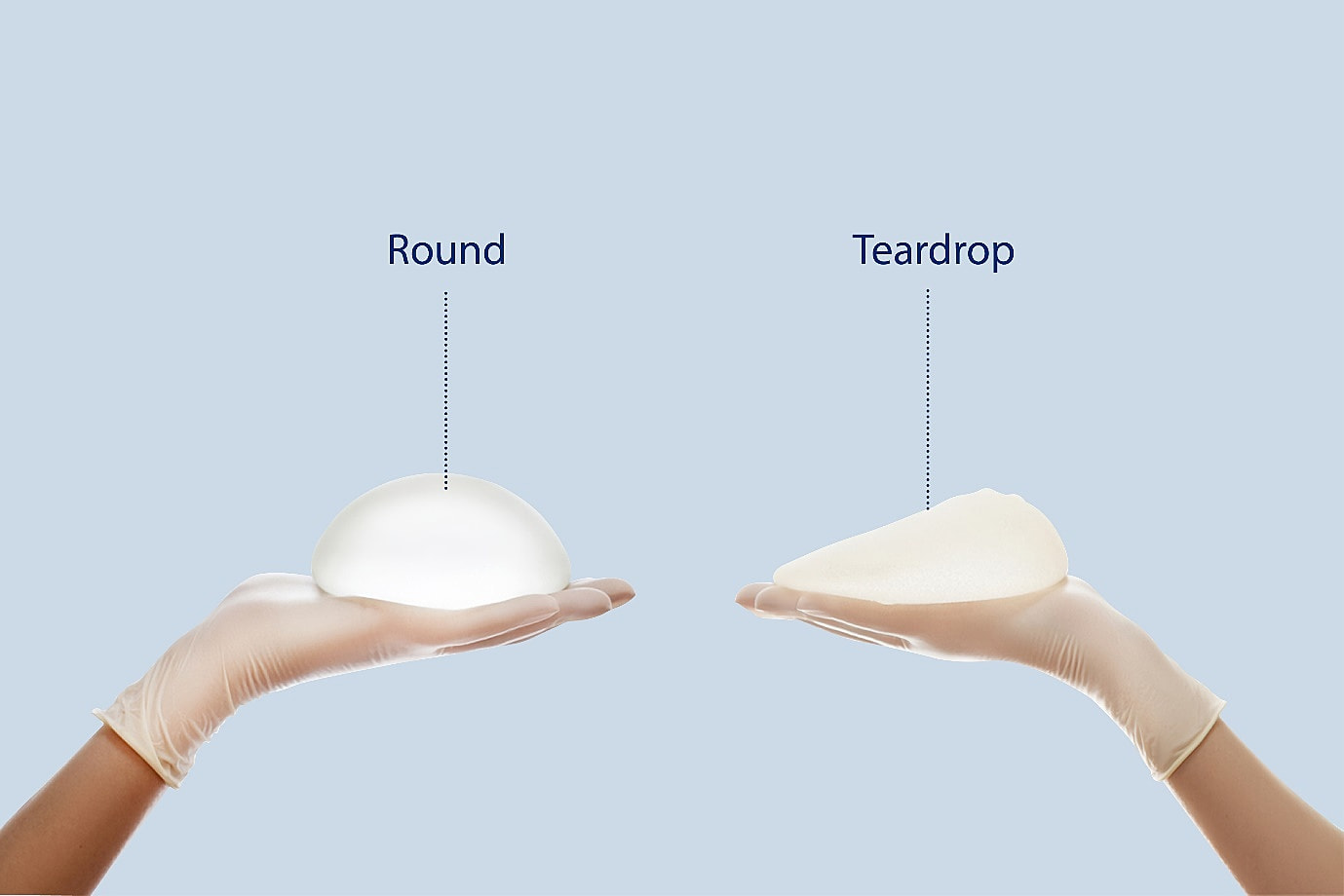 Frequently Asked Questions About Motiva® Implants | Dream Plastic Surgery