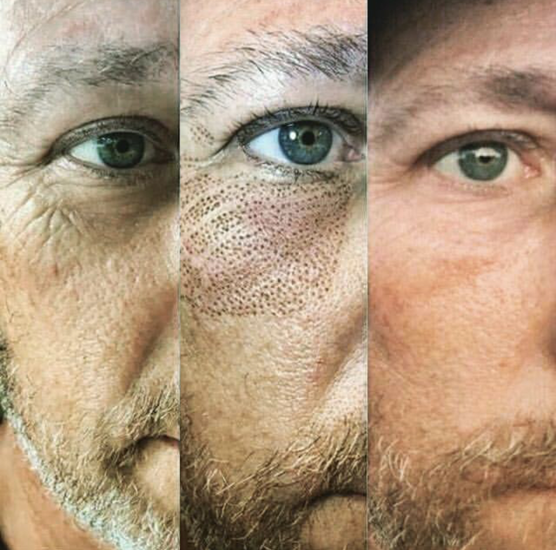 Fibro Blasting Dreamy Transformations