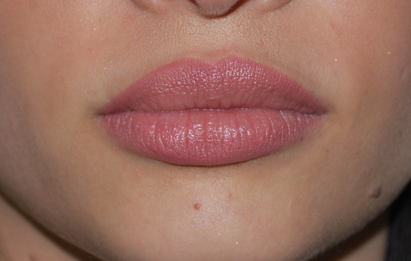 lip injections Dr. Earl Minuk's Blog