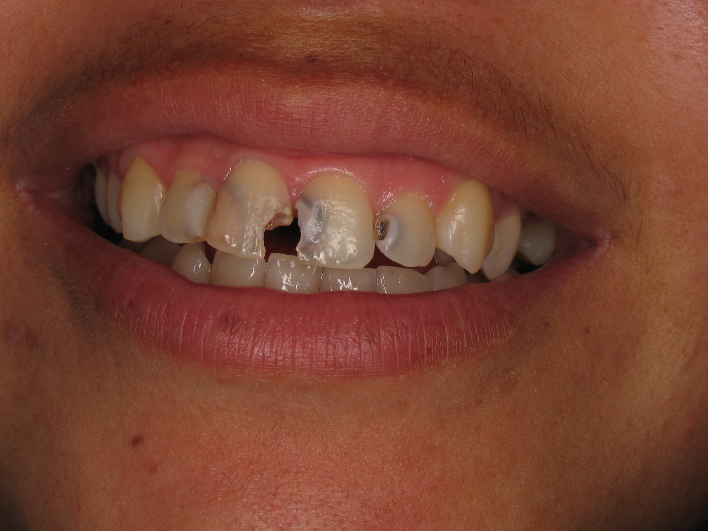 odontologia Via Oral