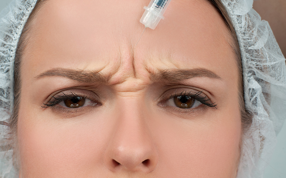 Zornesfalte glätten & behandeln in Düsseldorf Dr Face