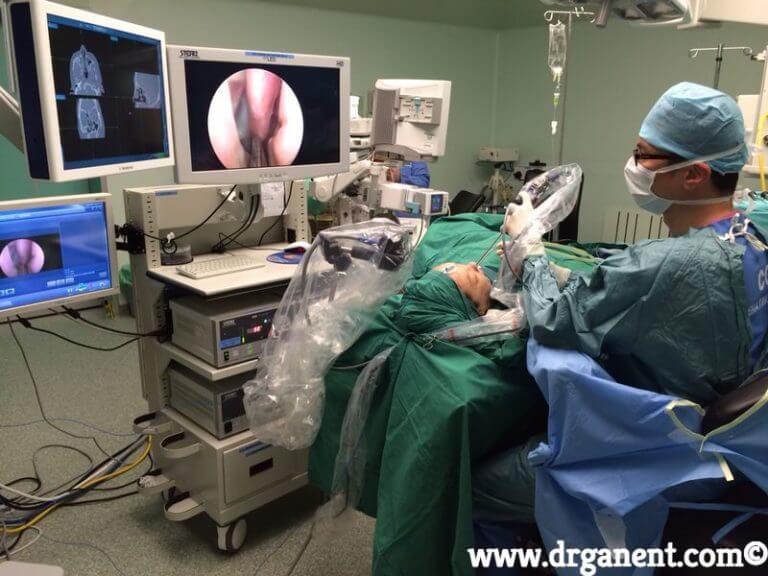 A Guide to Functional Endoscopic Sinus Surgery (FESS)