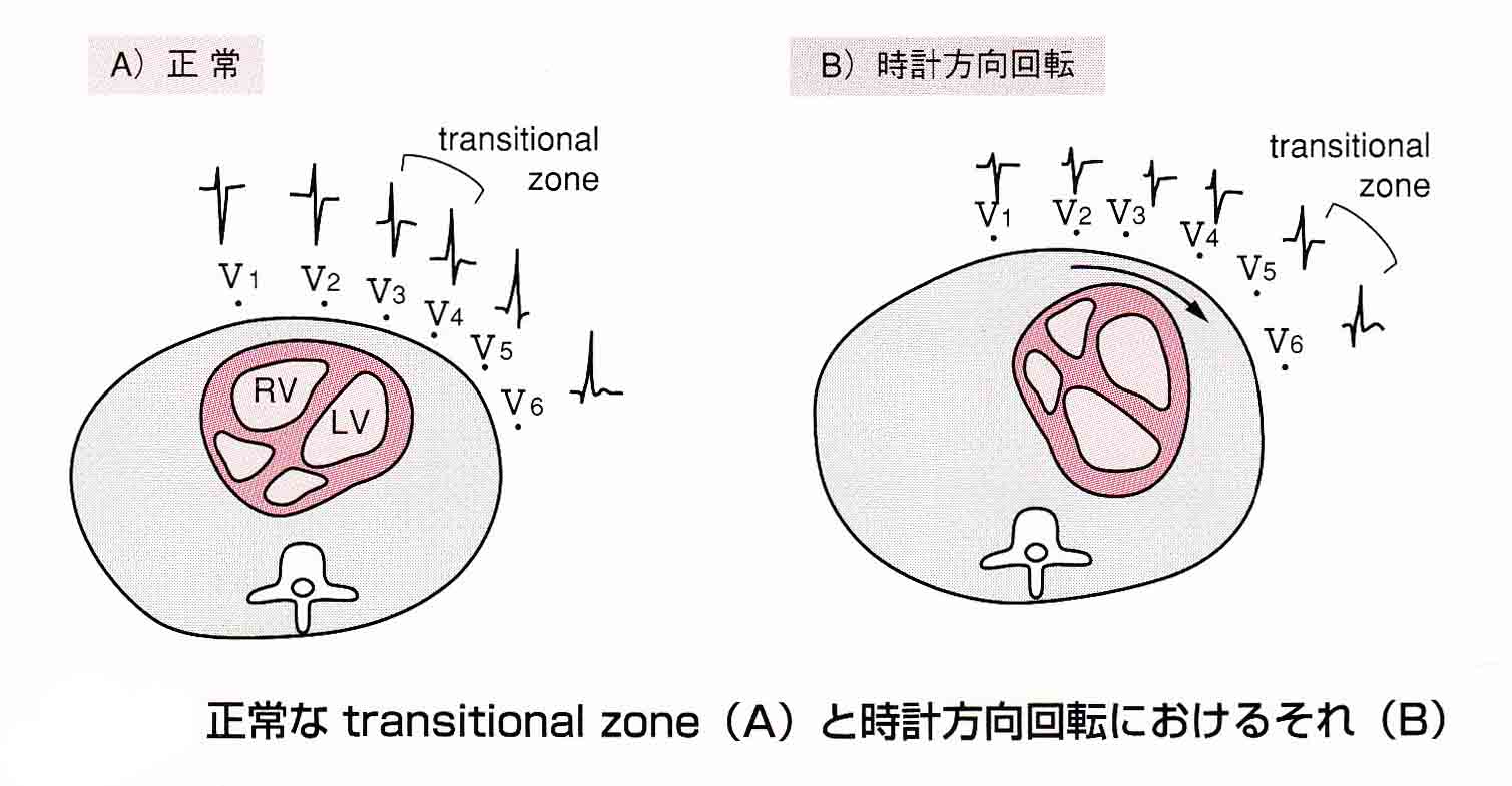 新潟の総合診療医、家庭医療専門医・Dr.がわそのBlog 時計方向、反時計方向回転