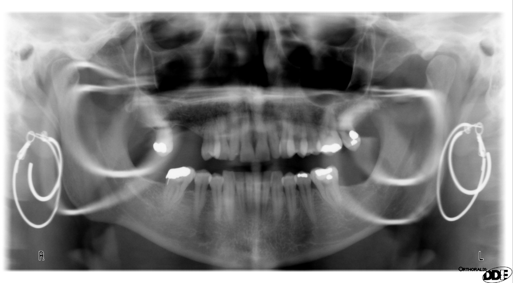 Radiographic Technique Patient preparation Dr. G's Toothpix