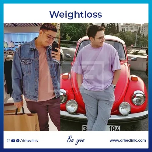 Body Contouring Surgery Cost Turkey 2024 Dr. HE Clinic