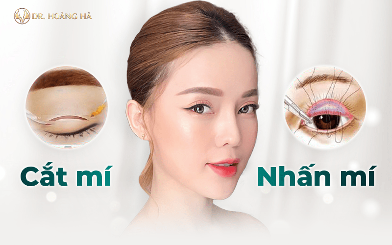 Nhấn mí và cắt mí có gì khác nhau? SỰ THẬT không phải ai cũng biết