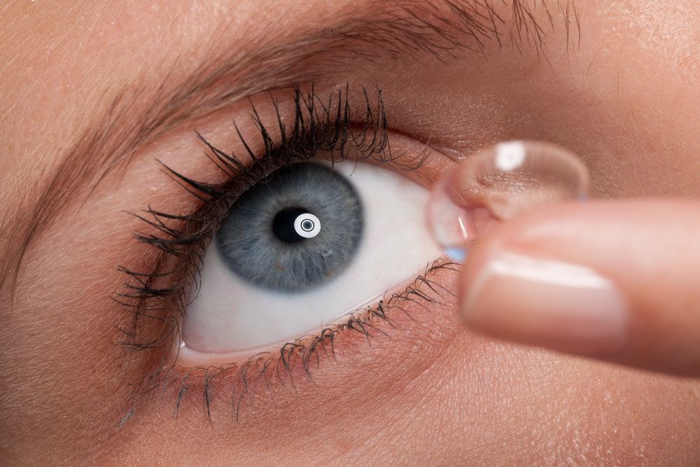 LASIK vs. Contact Lenses drholzman