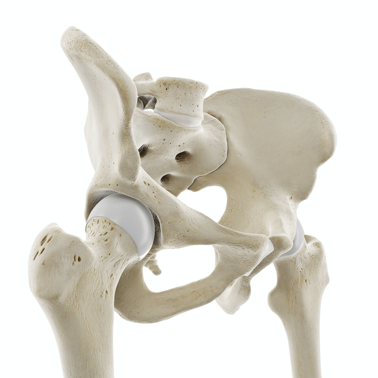 Hip replacement and resurfacing are surgical treatments for arthritis