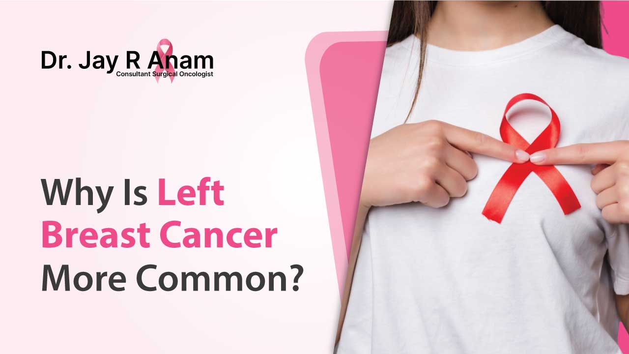 Why is Left Breast Cancer More Common?