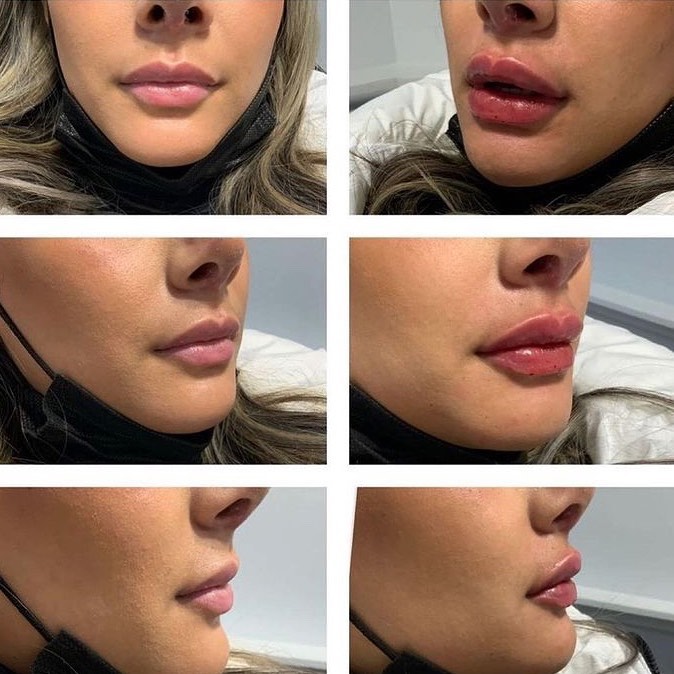 Lips Cheung Aesthetics & Wellness