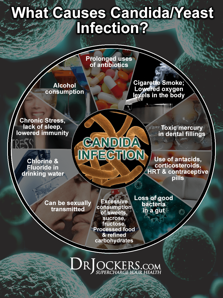 5 Crucial Steps to Heal Candida Naturally