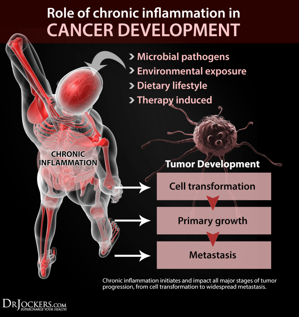 How Sugar Feeds Cancer Growth