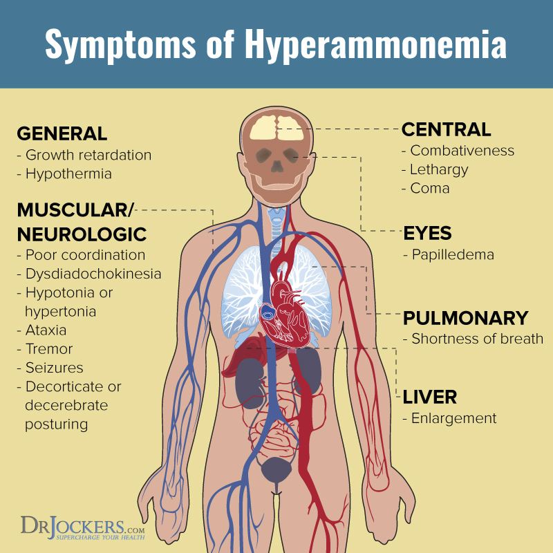 CBS Mutation and Low Sulfur Diet