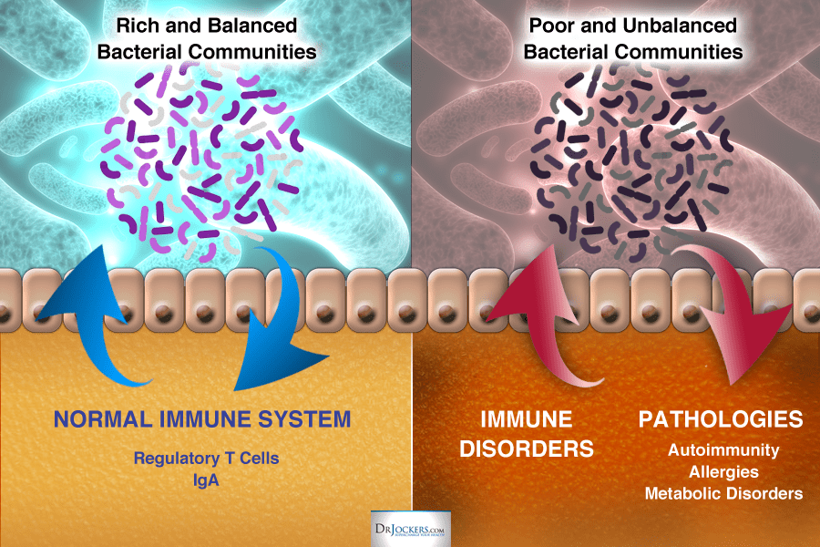 Is Your Gut to Blame For Anxiety and Acne