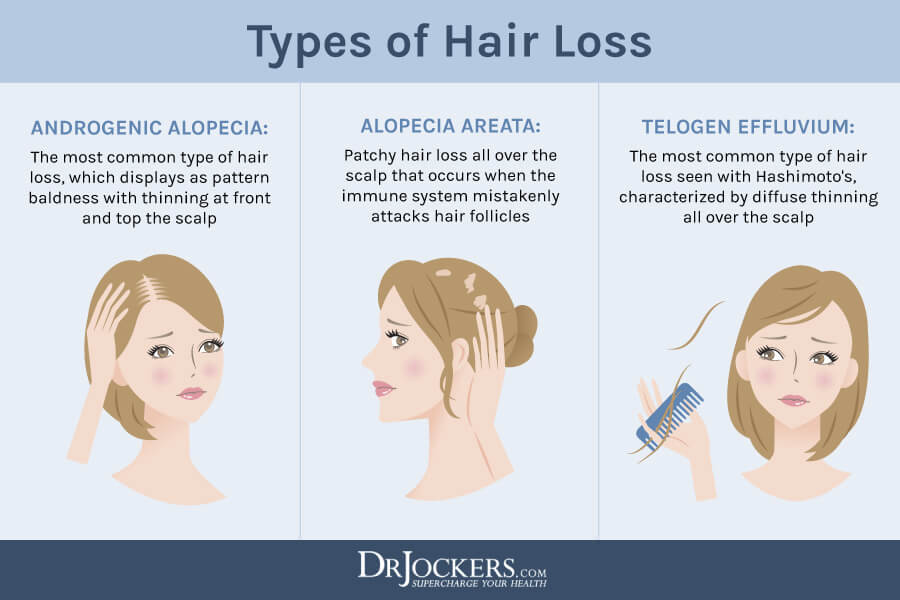 Is Perimenopause Hair Loss Permanent at Melisa Martin blog