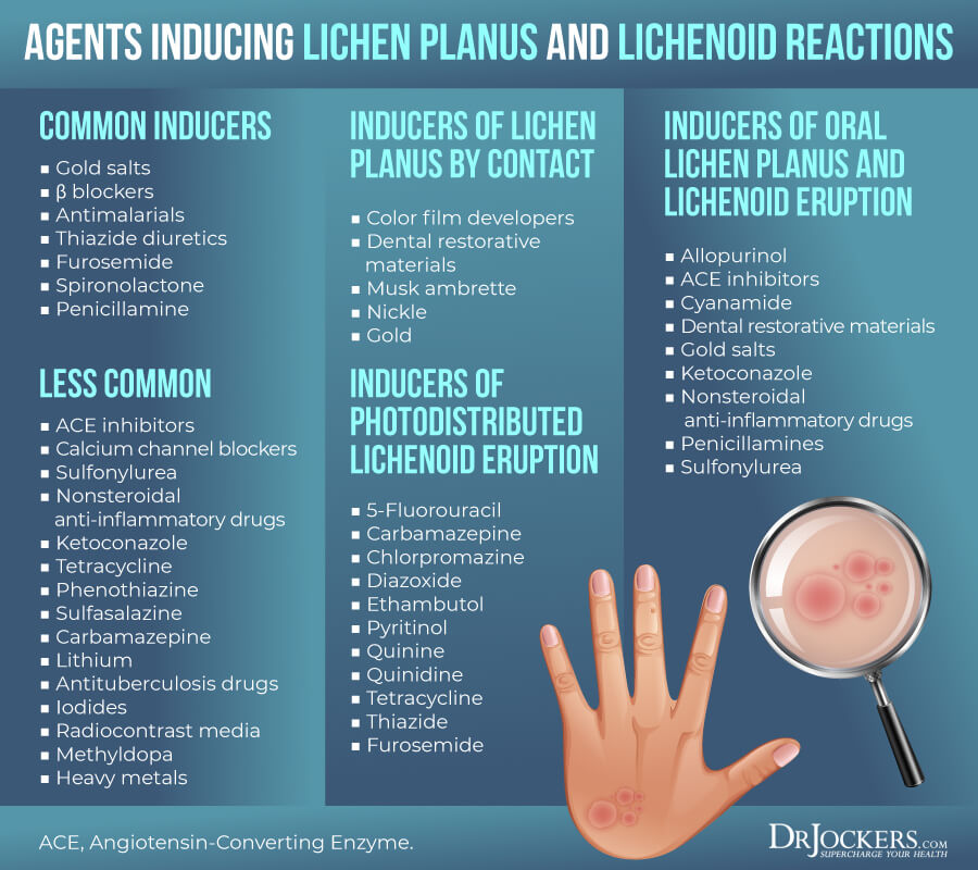 Lichen Planus Symptoms, Causes and Support Strategies