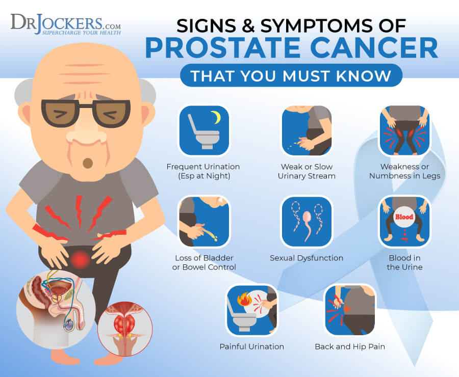 Prostate Cancer Symptoms, Causes and Support Strategies