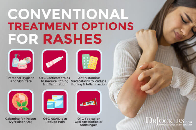 Skin Rashes Symptoms, Causes and Natural Support Strategies