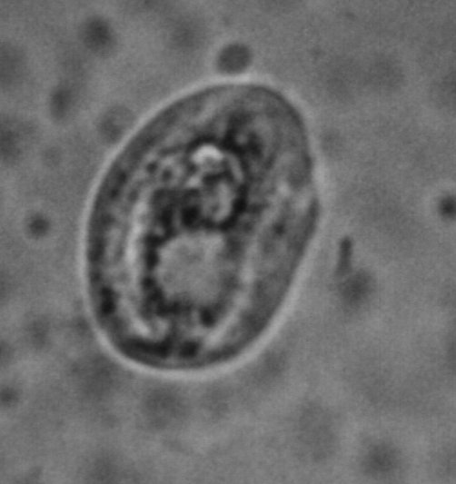 Chilodonella infections, rapid mortalities from this freshwater