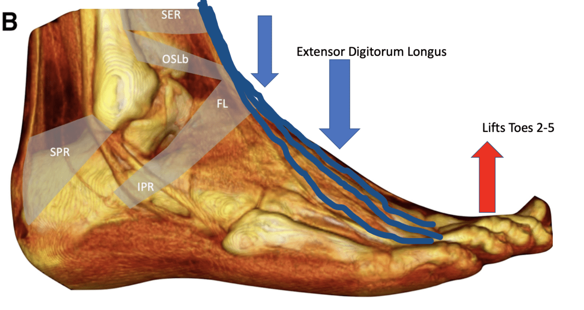 Extensor Digitorum Longus Anatomy, Pain and Exercises Dr. Justin Dean