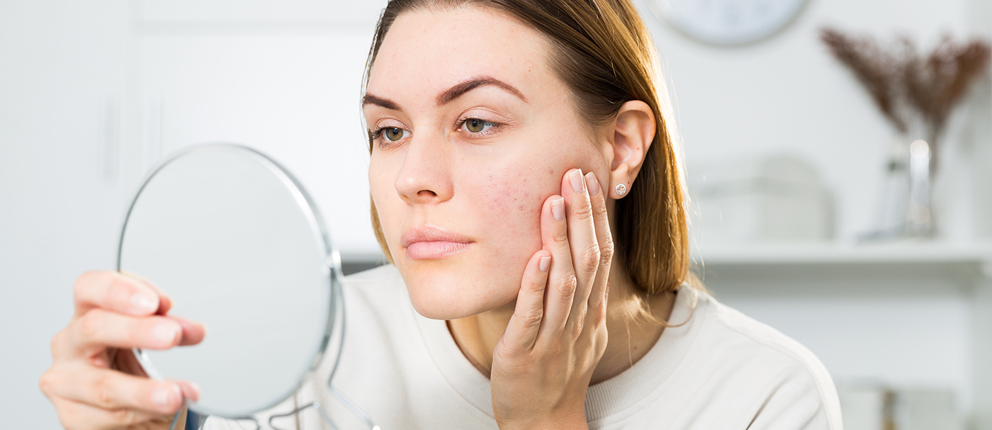 Acne Scars Treatment New Jersey TKI