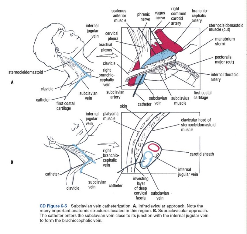 Internal Jugular Vein Catheterization « Review of Critical Care Medicine
