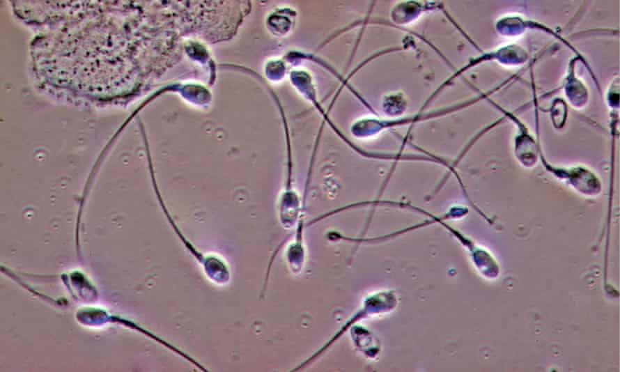 بهترین راه های افزایش تعداد اسپرم چیست؟ [عکس اسپرم ضعیف] دکتر حسین