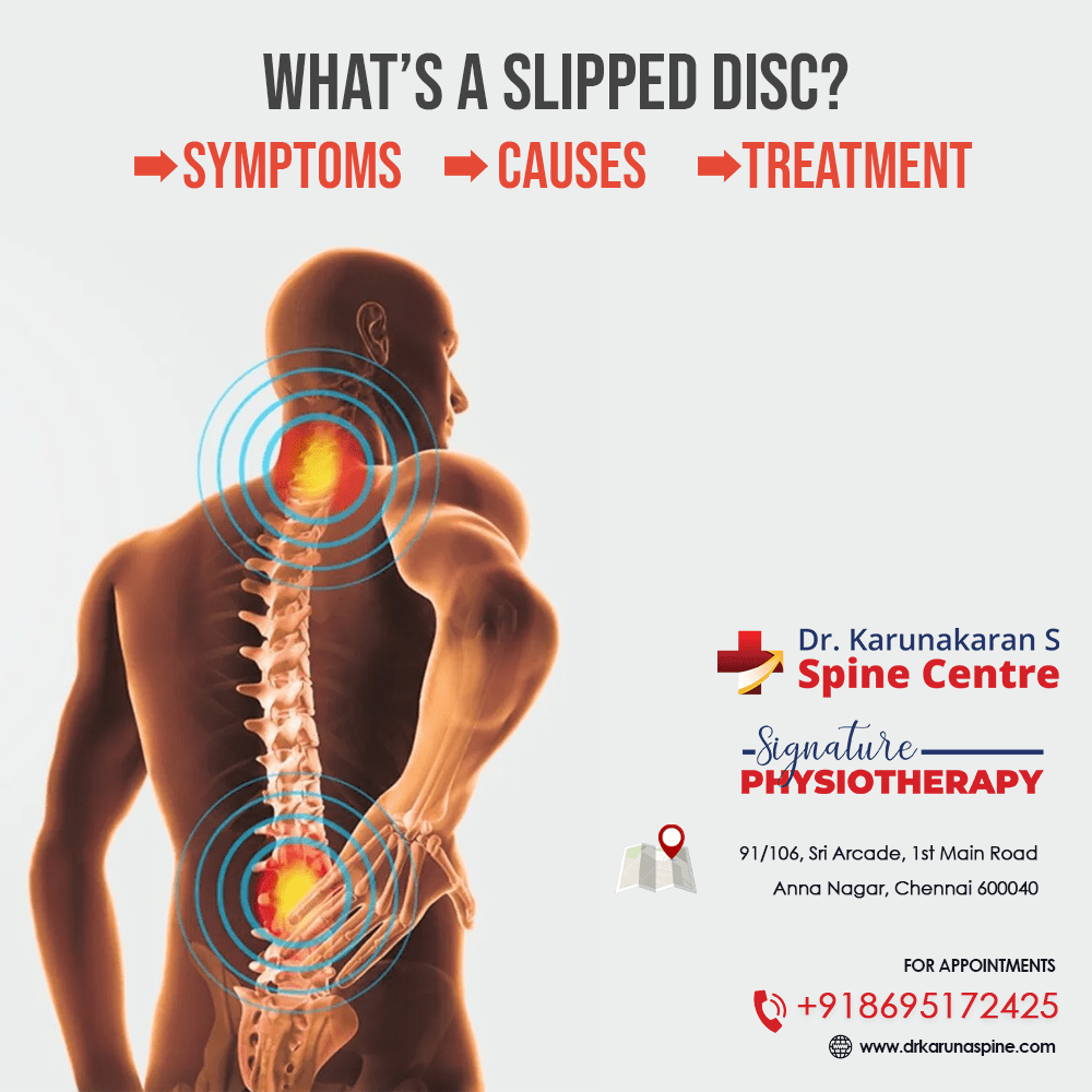 What’s a slipped disc? Best Spine Specialist In Chennai Dr