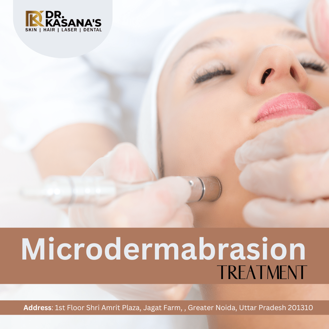 Microdermabrasion Facial Treatment Benefits, types, procedure & cost
