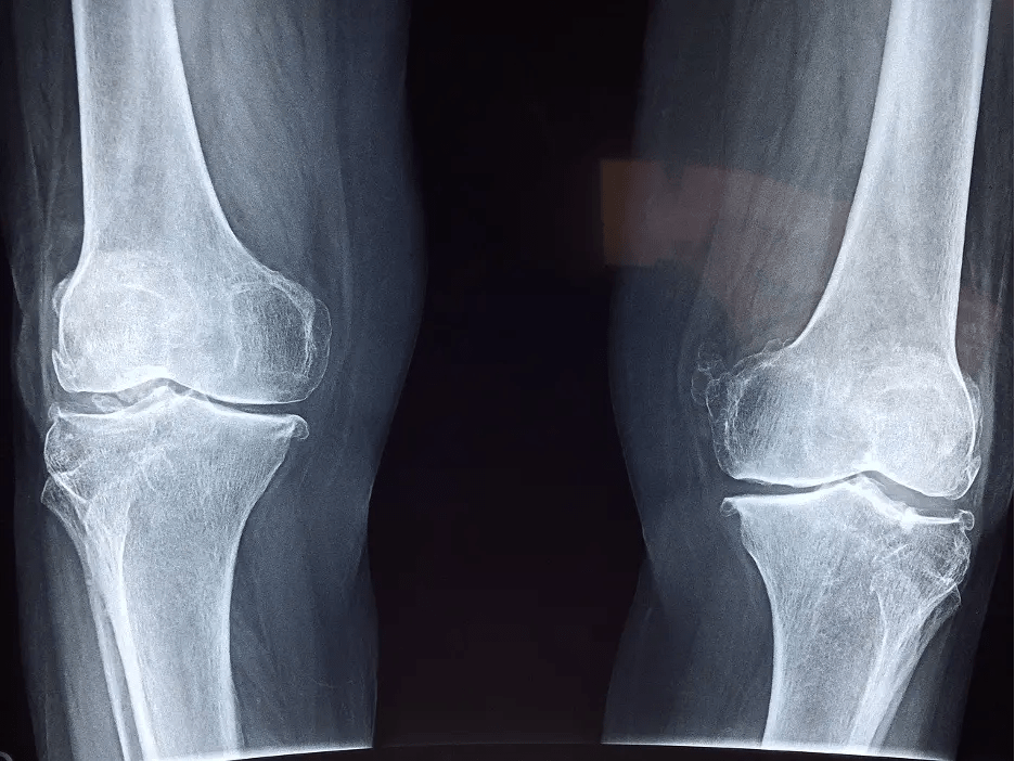 An Overview Orthopedics Orthopedic Surgeon Lubbock, TX Dr. Kevin Crawford, Sports Medicine