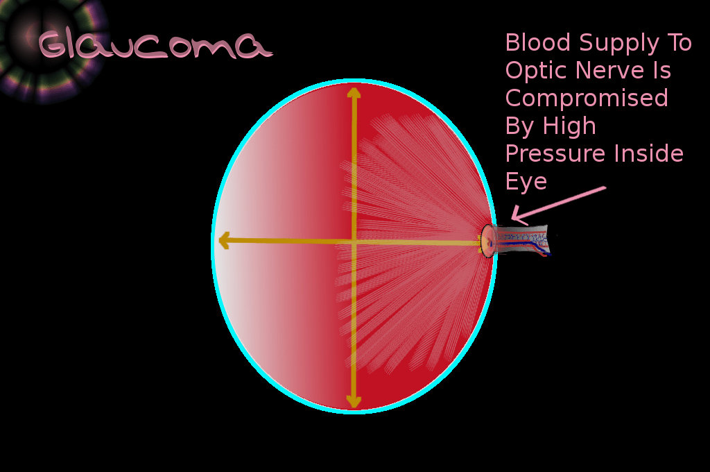 January is Awareness Month Harmony EyeCare Center Dr