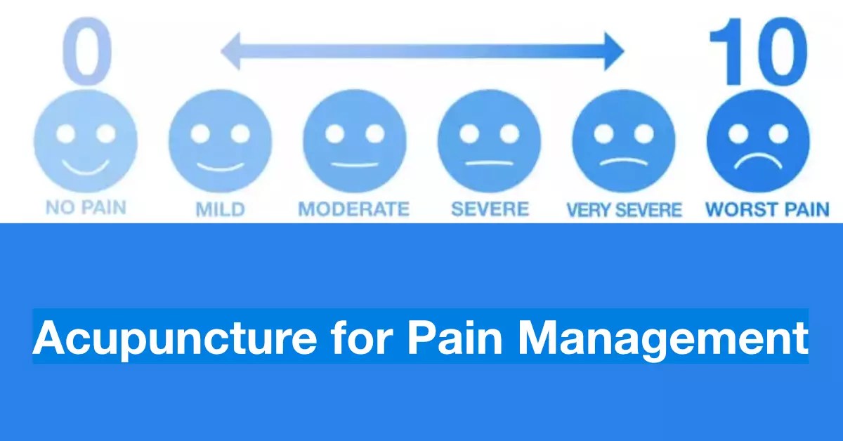 Acupuncture for Pain