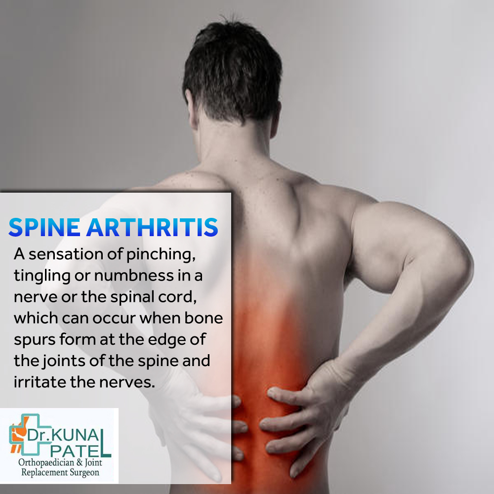 Spine Specialist Mumbai Dr. Kunal Patel