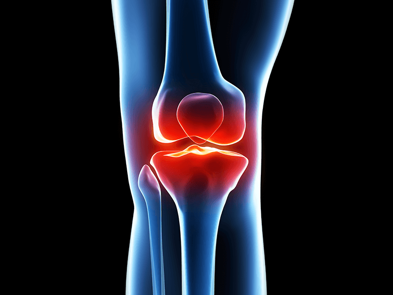 Adjusting To Life After A Joint Replacement Surgery Dr Kunal