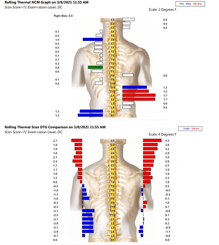 Ausweichen Blaze Zivilisation rolling thermal scan ncm bar graph Inhalt Nebel Regenschirm