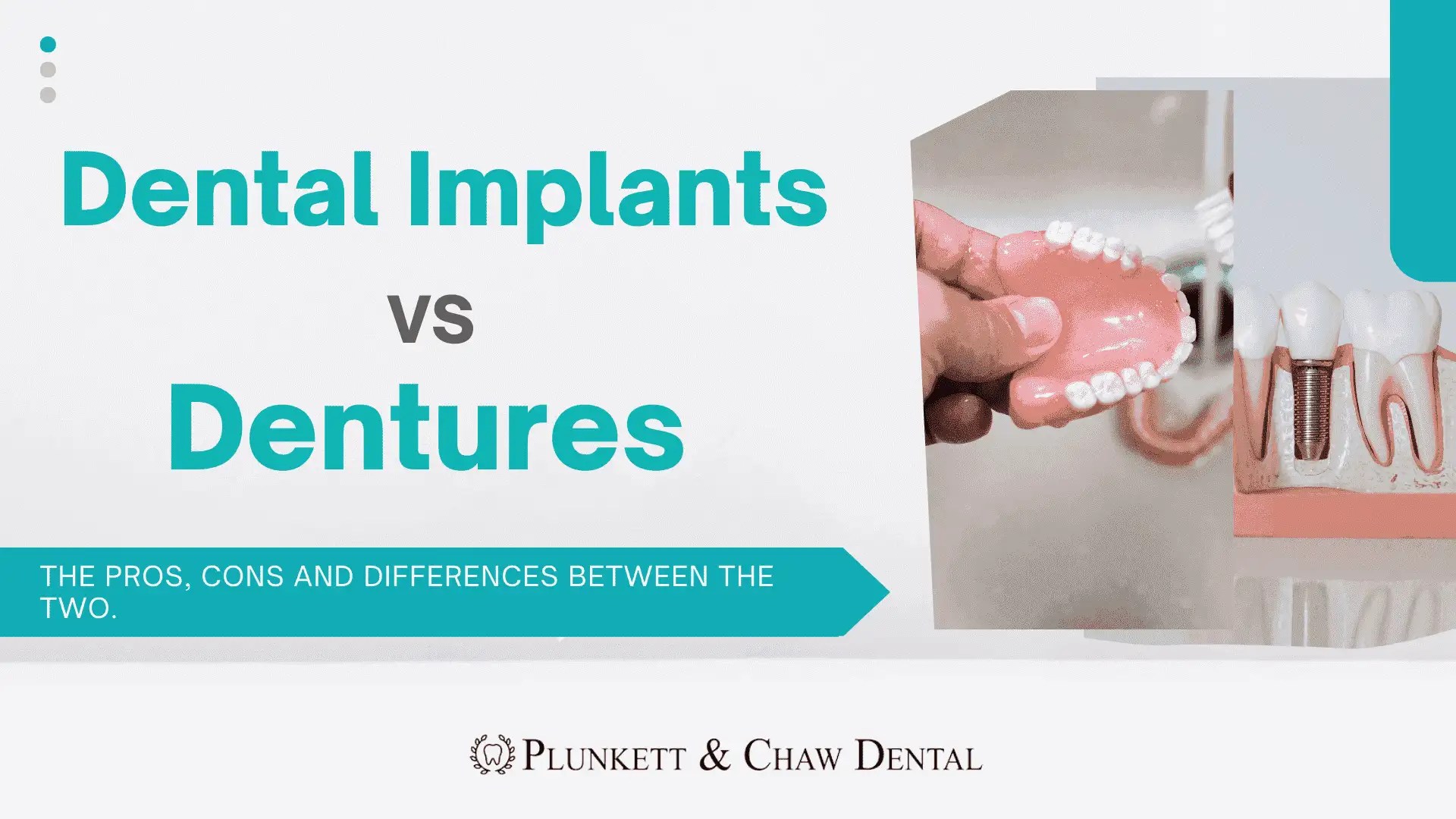 Dental Implants Archives Plunkett & Chaw Dental