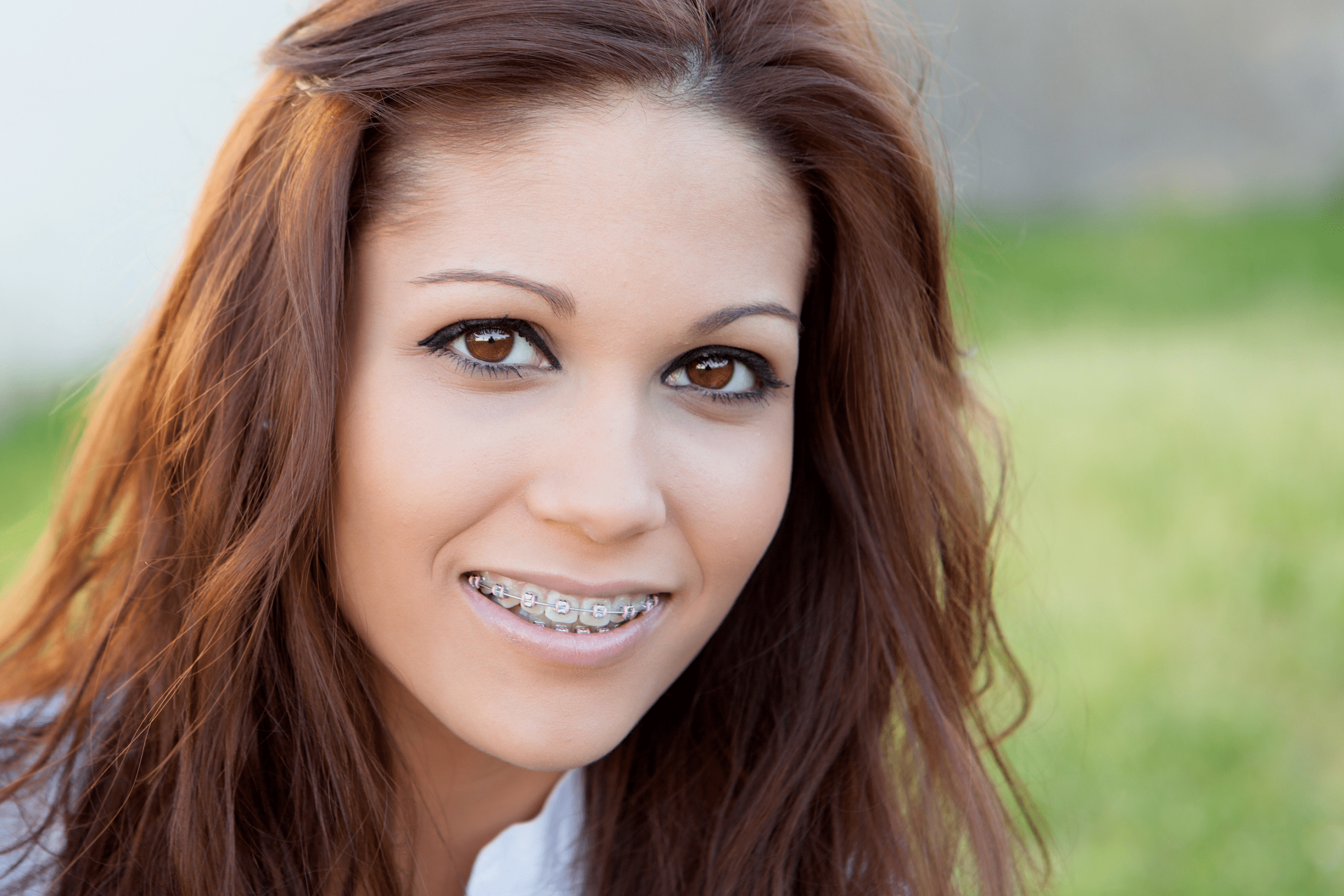 Average Cost Of Braces Near Me DR. LINTS ORTHODONTICS