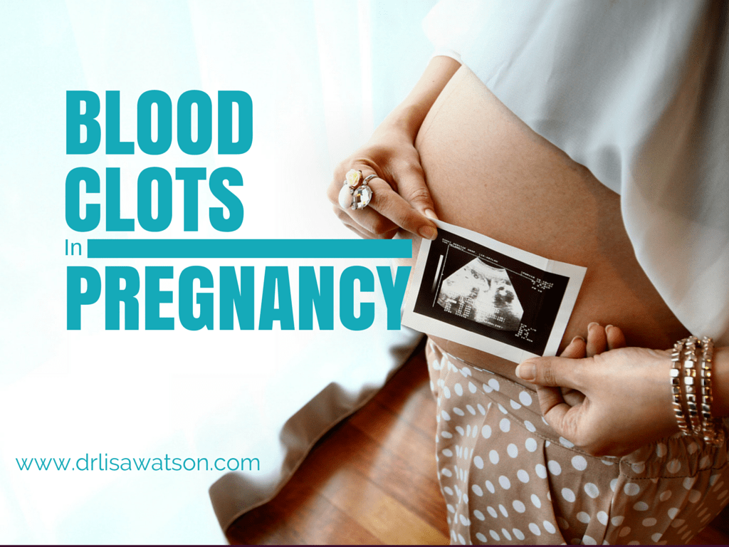 Blood Clots in Pregnancy Dr. Lisa Watson