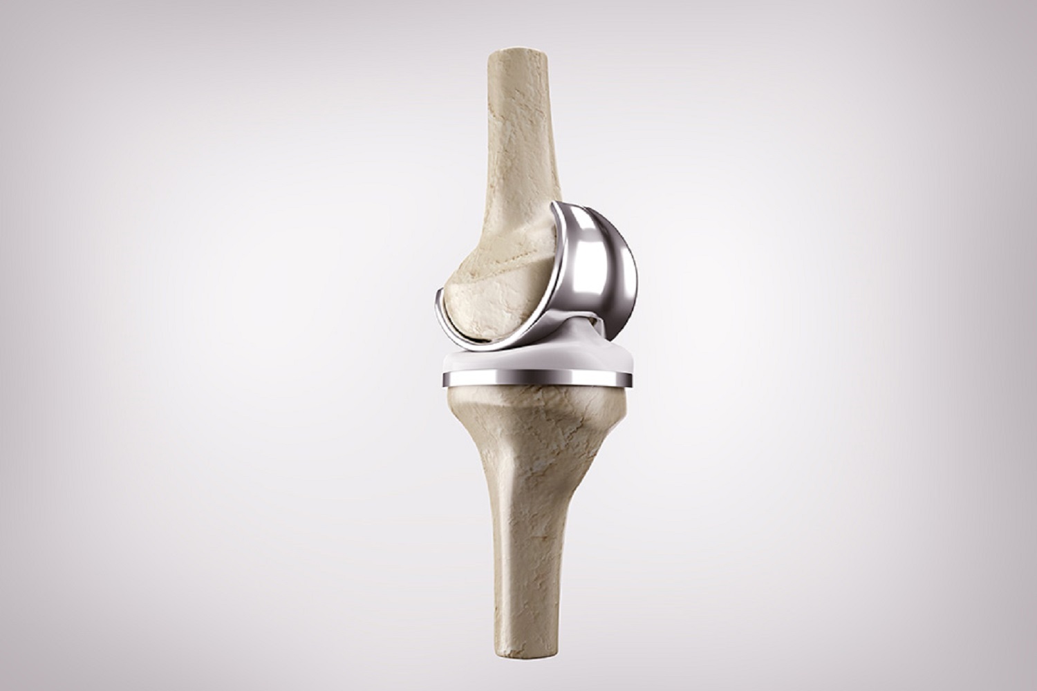 kneereplacement Dr. L Tomar