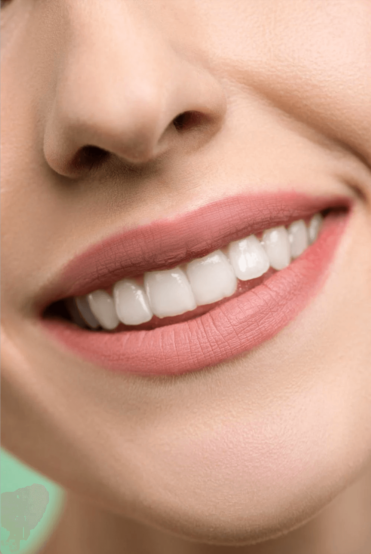 Transforming a “Gummy Smile” Can Be a Game Changer Lucas Orthodontics