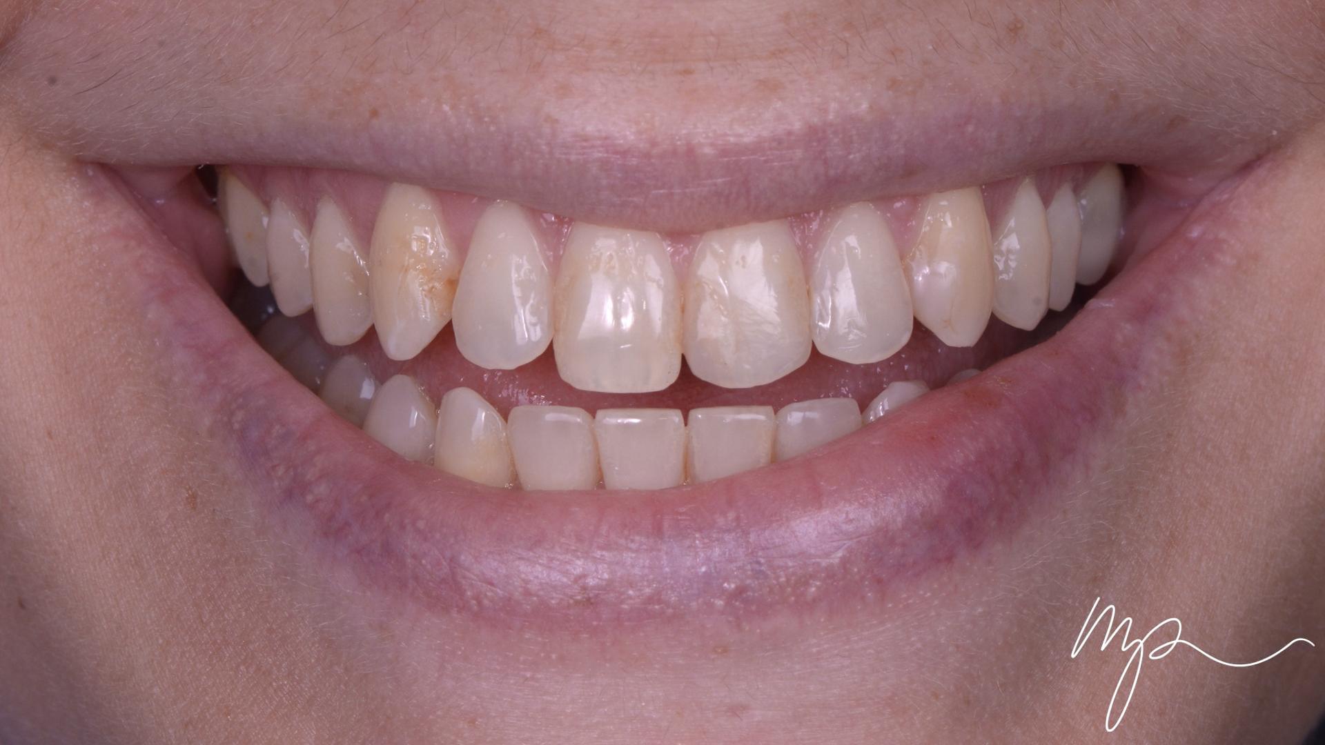 Dentisterie Esthétique Dr Marin Pomperski Chirurgien Dentiste