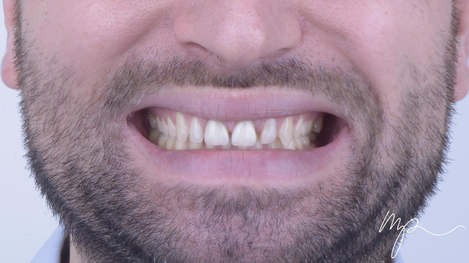 Dentisterie Esthétique Dr Marin Pomperski Chirurgien Dentiste