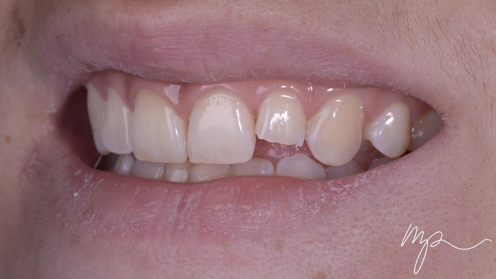 Dentisterie Esthétique Dr Marin Pomperski Chirurgien Dentiste