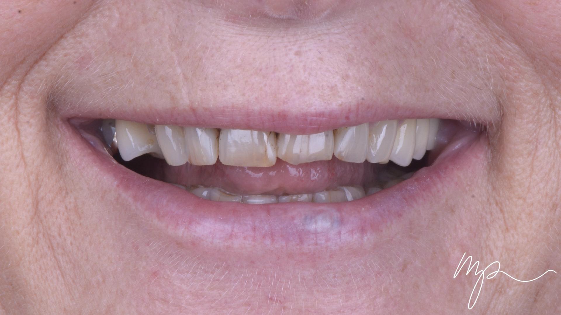 Dentisterie Esthétique Dr Marin Pomperski Chirurgien Dentiste