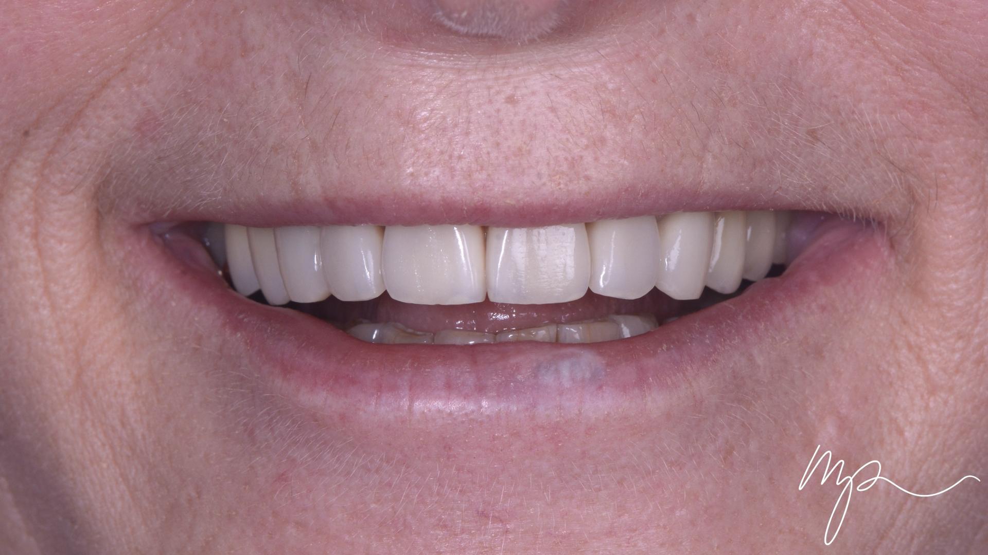 Dentisterie Esthétique Dr Marin Pomperski Chirurgien Dentiste