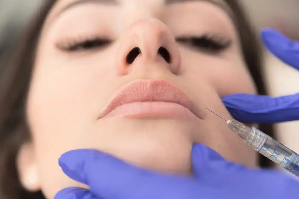 Dissolving Lip Fillers Hyaluronidase injections Dr. Matla