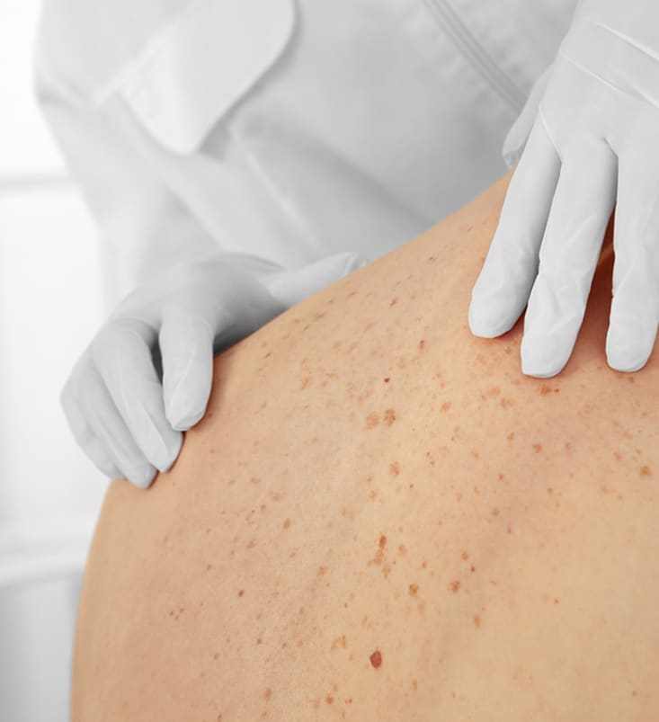 Medical Dermatology Near Me El Campo TX Victoria, Bay City, Wharton