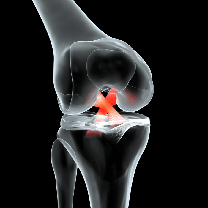 ACL Injury Symptoms and Treatments • Dr. Paul Miano Acl austin festival